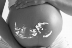 VBAC: What You Should Know