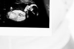 Antenatal screens and tests