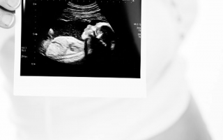 Antenatal screens and tests