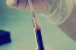 Genetic testing