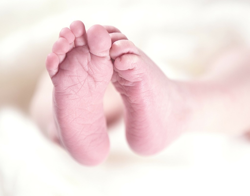 Clubfoot: Symptoms, Causes & Treatment