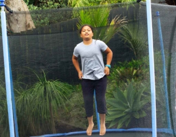 Top Tips To Prevent Trampoline Injuries For Tamariki